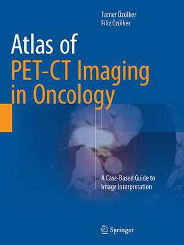 Cover image for Atlas of PET-CT Imaging in Oncology: A Case-Based Guide to Image Interpretation