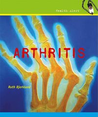 Cover image for Arthritis