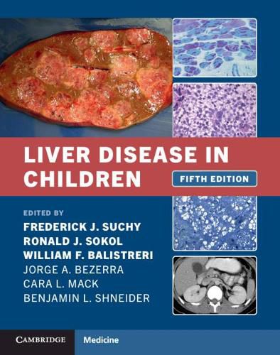 Cover image for Liver Disease in Children