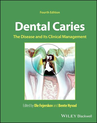 Dental Caries