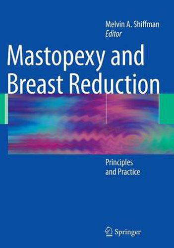 Cover image for Mastopexy and Breast Reduction: Principles and Practice