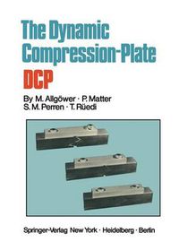 Cover image for The Dynamic Compression Plate DCP