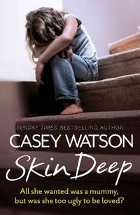 Cover image for Skin Deep: All She Wanted Was a Mummy, but Was She Too Ugly to be Loved?