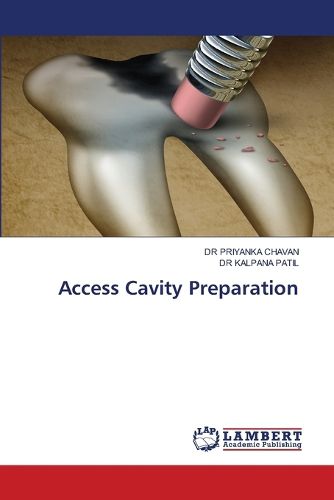 Cover image for Access Cavity Preparation