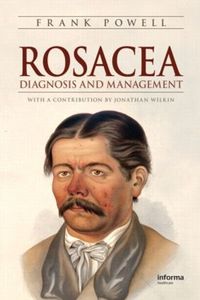 Cover image for Rosacea: Diagnosis and Management