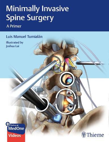 Cover image for Minimally Invasive Spine Surgery: A Primer