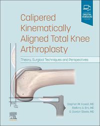 Cover image for Calipered Kinematically aligned Total Knee Arthroplasty: Theory, Surgical Techniques and Perspectives