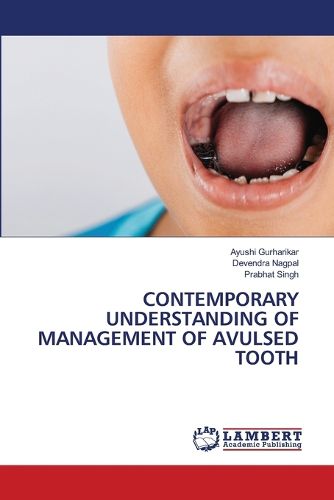 Cover image for Contemporary Understanding of Management of Avulsed Tooth