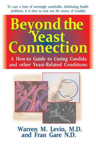 Cover image for Beyond the Yeast Connection: A How-to Guide to Curing Candida and Other Yeast-Related Conditions