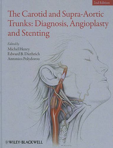 The Carotid and Supra-Aortic Trunks: Diagnosis, Angioplasty and Stenting