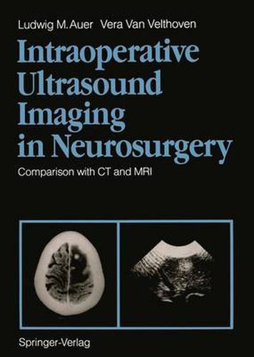 Cover image for Intraoperative Ultrasound Imaging in Neurosurgery: Comparison with CT and MRI