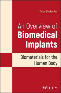 Cover image for An Overview of Biomedical Implants