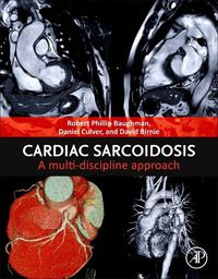 Cover image for Cardiac Sarcoidosis