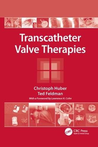 Cover image for Transcatheter Valve Therapies