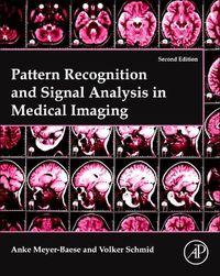 Cover image for Pattern Recognition and Signal Analysis in Medical Imaging