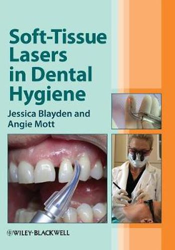 Cover image for Soft-Tissue Lasers in Dental Hygiene