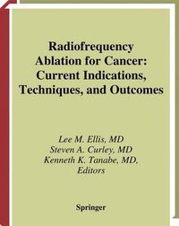 Cover image for Radiofrequency Ablation for Cancer: Current Indications, Techniques, and Outcomes