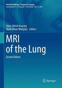 Cover image for MRI of the Lung