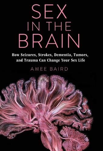 Cover image for Sex in the Brain: How Seizures, Strokes, Dementia, Tumors, and Trauma Can Change Your Sex Life