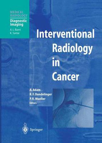 Cover image for Interventional Radiology in Cancer