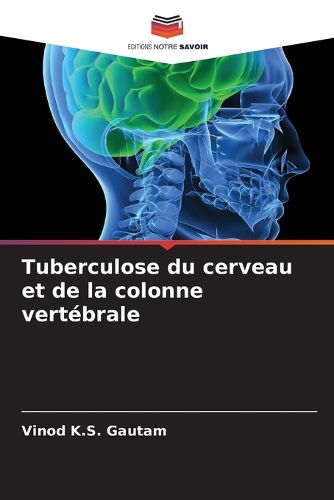 Cover image for Tuberculose du cerveau et de la colonne vertebrale