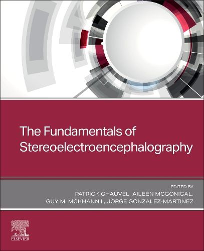 Cover image for The Fundamentals of Stereoelectroencephalography