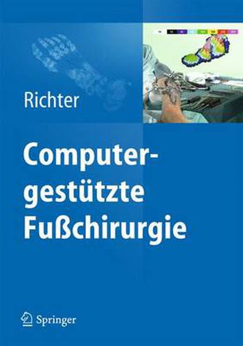 Cover image for Computergestutzte Fusschirurgie: Intraoperative 3-D-Roentgenbildgebung, Navigation, Intraoperative Pedographie