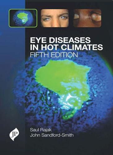 Cover image for Eye Diseases in Hot Climates