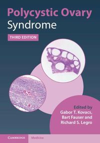 Cover image for Polycystic Ovary Syndrome