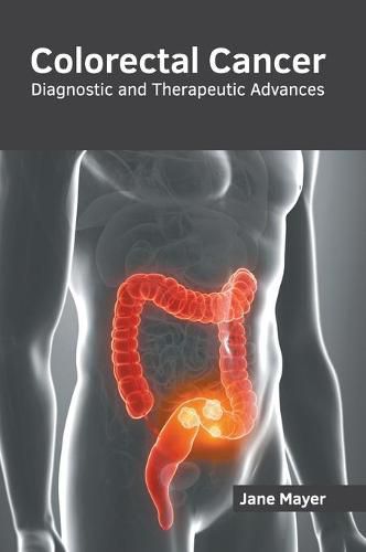 Colorectal Cancer: Diagnostic and Therapeutic Advances