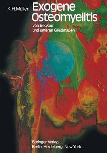 Cover image for Exogene Osteomyelitis von Becken und Unteren Gliedmassen