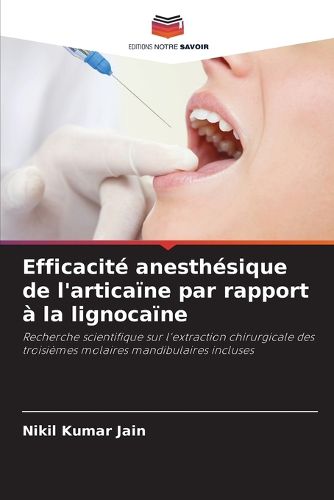 Cover image for Efficacite anesthesique de l'articaine par rapport a la lignocaine