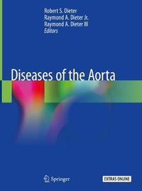 Cover image for Diseases of the Aorta