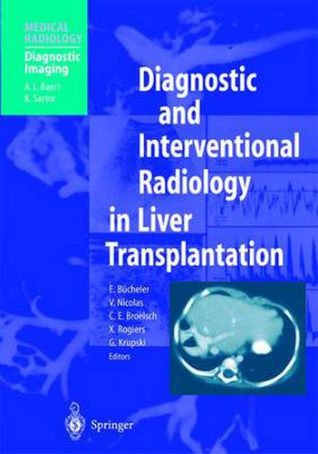 Cover image for Diagnostic and Interventional Radiology in Liver Transplantation